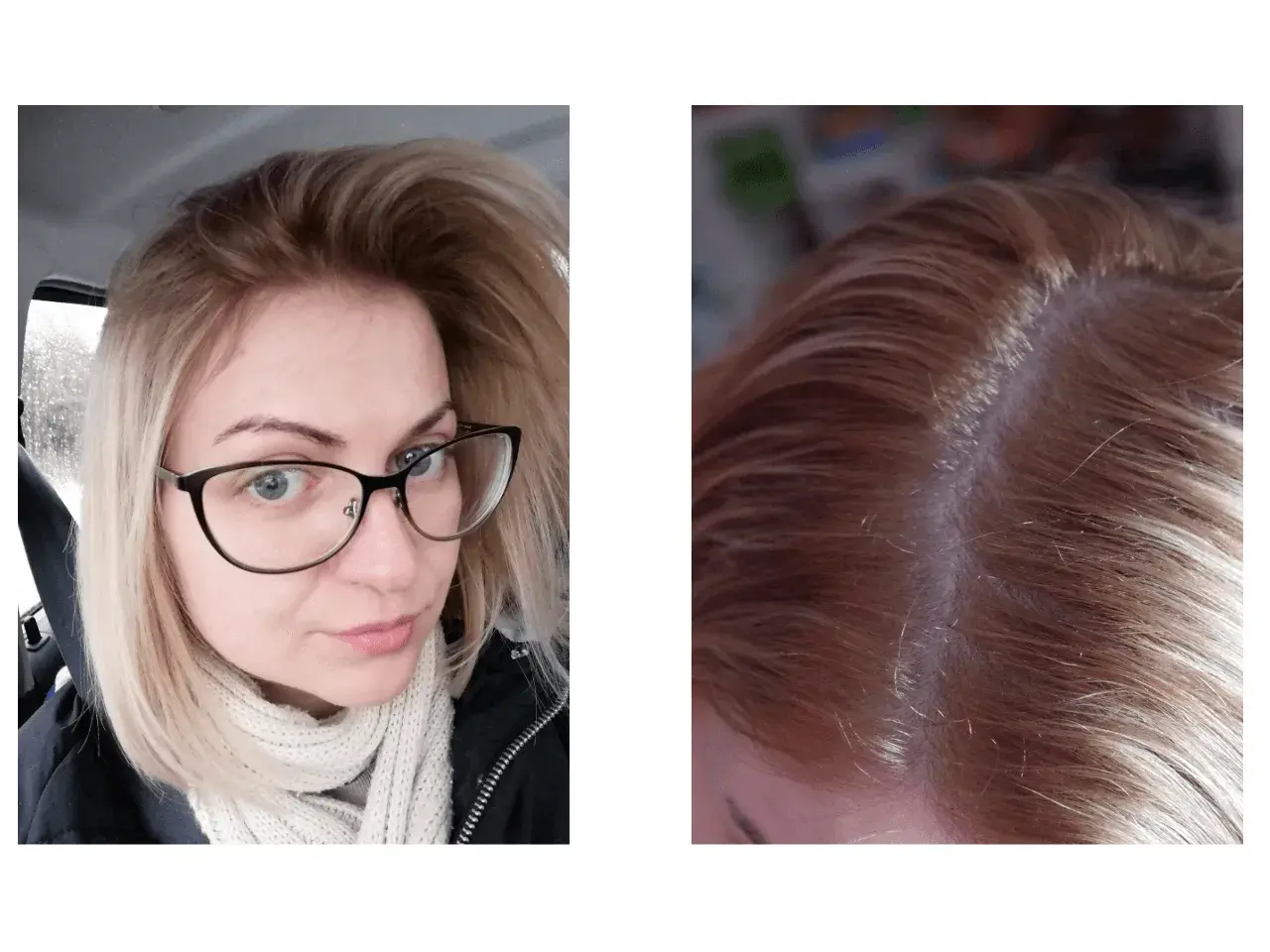 Kobieta z okularami i jasnymi, blond włosami. Widoczne odrosty na głowie.
